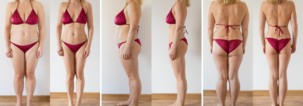 Personalized GLP-1 Dosing Online | TBTotal.Health