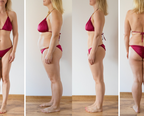 Personalized GLP-1 Dosing Online | TBTotal.Health